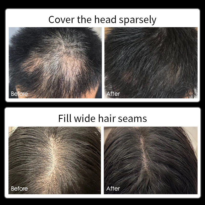 Ginzo Scalp Concealer Crema Co - Hair Care Lotion recensione e prezzo