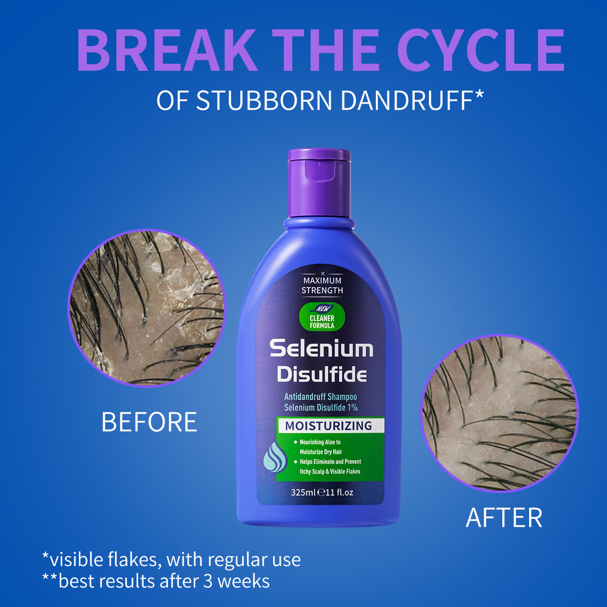 Shampoo Anticaduta al Disolfur - Hair Care Dandruff recensione e prezzo
